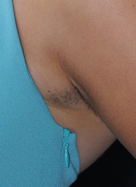 XPOSURE_P_LOTT_002-181